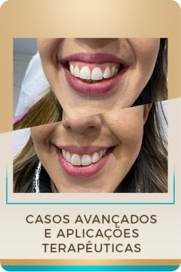 mo_odulo_4.webp
